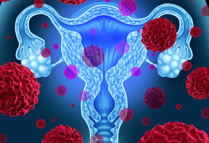 Prévenir le cancer du col de l’utérus