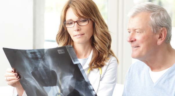 Le cancer du côlon tue plus que les accidents de la route