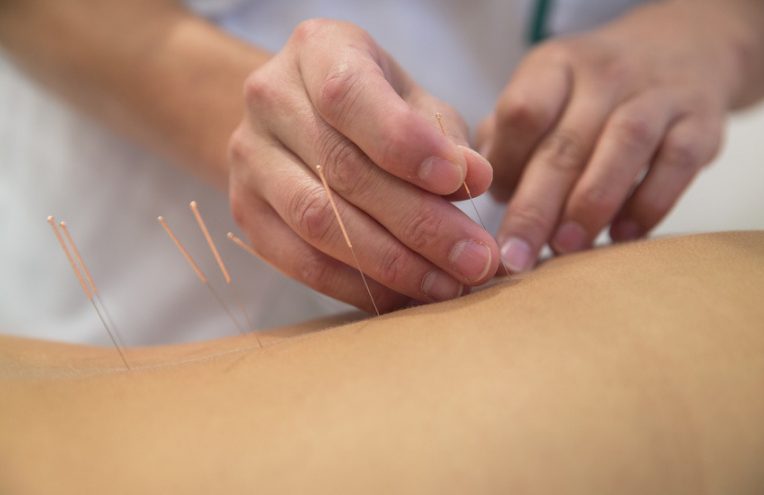 « L’acupuncture, oui, j’avoue, ça m’a aidé »