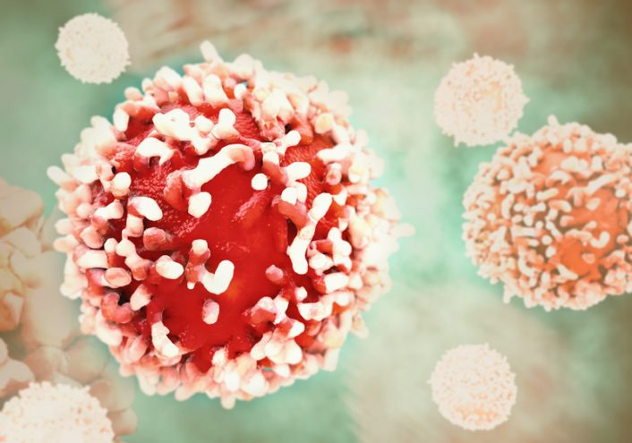 Immuno-oncologie : des avancées riches d’espoirs