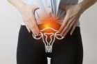 Le cancer de l’ovaire en 8 questions
