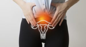 Le cancer de l’ovaire en 8 questions