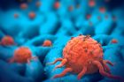 Traitement du cancer : et si on affamait les tumeurs ?