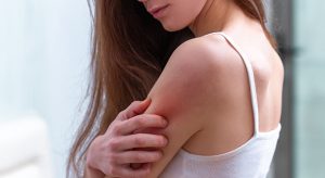 Psoriasis et eczéma : comment soulager les poussées ?